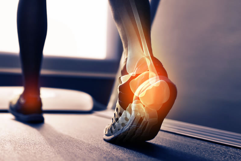 visual of foot bones running on treadmill